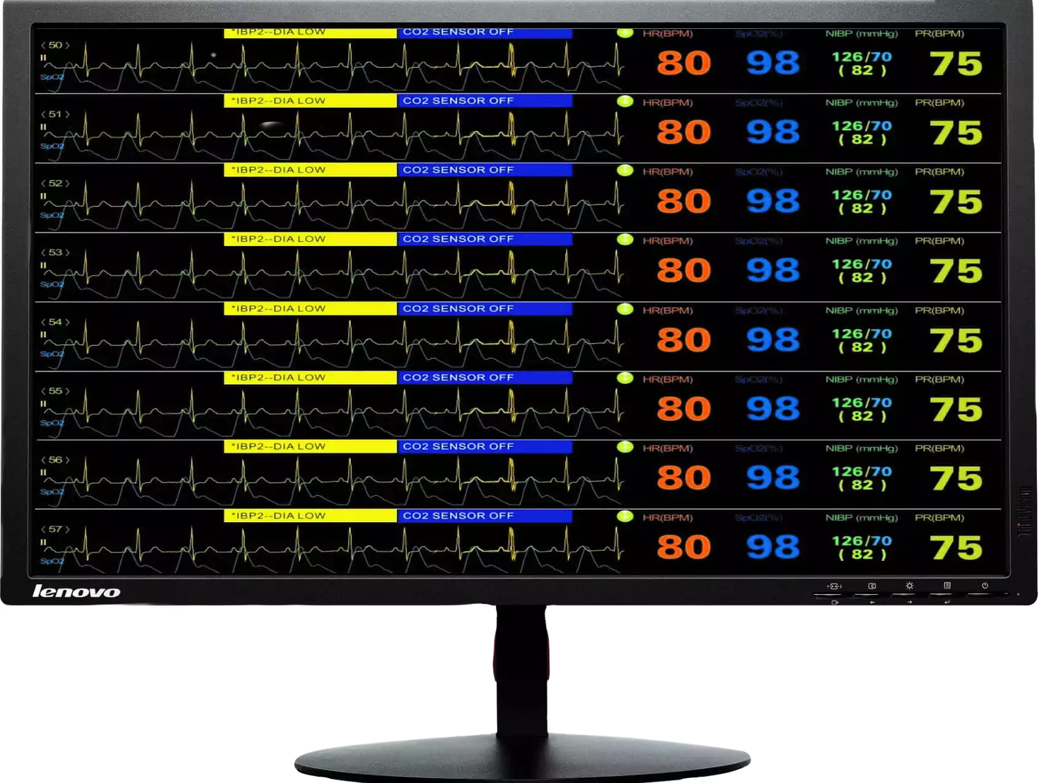 PC-Macs Series – ekran za centralno praćenje više pacijenata